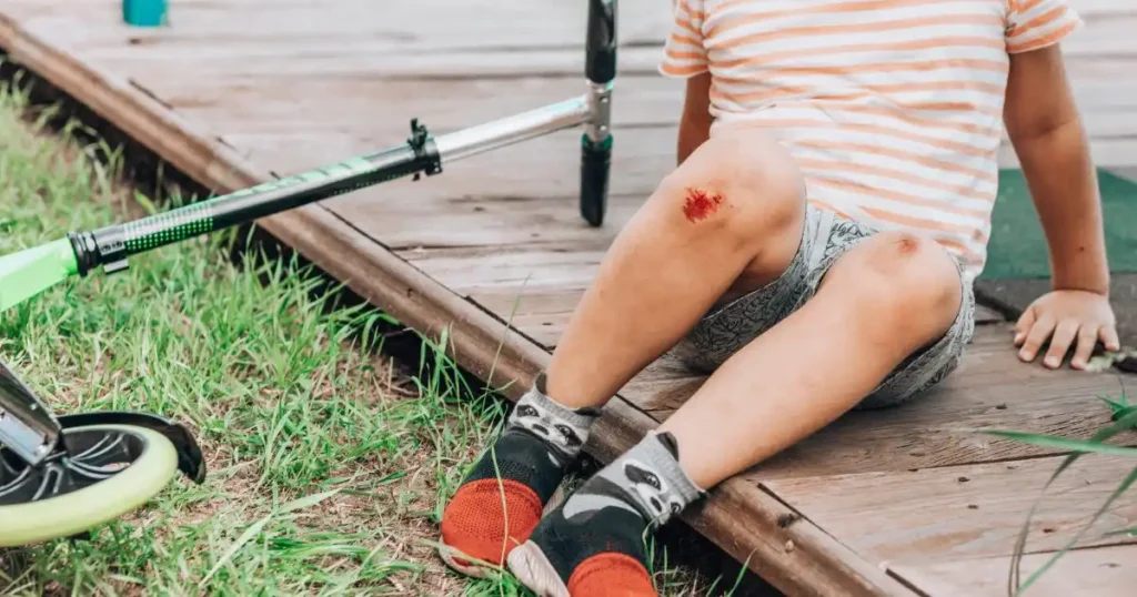 Pros and Cons of Electric Scooters in the UAE 3 Rider injured on electric scooter